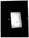 Fig. 07 - [Disposable Magnifying Reader and Container]
