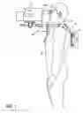 Fig. 02 - Shoulder mounted support assembly to hold camera of camcorder