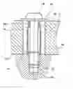 Fig. 01 - Supporting bushing