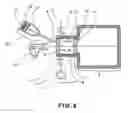 Fig. 07 - Load-lock technique