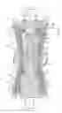 Fig. 09 - Rotor for a steam turbine