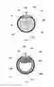 Fig. 02 - Implantable drug delivery device for sustained release of therapeutic agent
