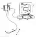 Fig. 01 - Tooth shade analyzer system and methods