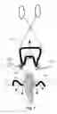 Fig. 05 - Gingival retraction device and method