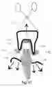 Fig. 07 - Gingival retraction device and method