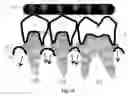 Fig. 09 - Gingival retraction device and method