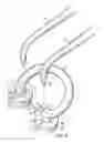 Fig. 03 - DEVICE AND SYSTEM FOR SEPARATION AND MATRIX RETENTION AND ADAPTATION DURING DENTAL RESTORATION AND METHOD FOR PREPARING TOOTH USING SYSTEM