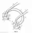 Fig. 04 - DEVICE AND SYSTEM FOR SEPARATION AND MATRIX RETENTION AND ADAPTATION DURING DENTAL RESTORATION AND METHOD FOR PREPARING TOOTH USING SYSTEM