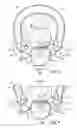 Fig. 06 - DEVICE AND SYSTEM FOR SEPARATION AND MATRIX RETENTION AND ADAPTATION DURING DENTAL RESTORATION AND METHOD FOR PREPARING TOOTH USING SYSTEM