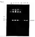 Fig. 04 - Method of gene amplification