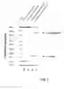 Fig. 02 - Diagnosis kit, dna chip, and methods for diagnosing or supervising the treatment of testicular cancer