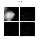 Fig. 07 - Method of analyzing organelle-localized protein and materials for analysis