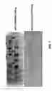Fig. 02 - Methods for conducting assays for enzyme activity on protein microarrays