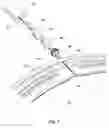 Fig. 08 - Seal for coaxial cable in downhole tools