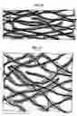 Fig. 02 - Stitch-bonded fabrics utilizing stretchable substrates
