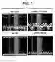 Fig. 02 - Remedy for ischemic heart failure