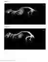 Fig. 04 - Method for treating bone loss using parathyroid hormone