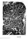 Fig. 09 - Method for treating bone loss using parathyroid hormone