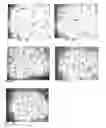 Fig. 02 - Composition comprising an angiogenesis related protein