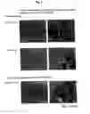 Fig. 03 - Antibody recognizing proliferative human liver cells, proliferative human liver cells and functional human liver cells