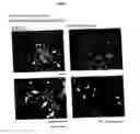 Fig. 04 - Antibody recognizing proliferative human liver cells, proliferative human liver cells and functional human liver cells