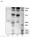 Fig. 02 - Method of separating glycolipids