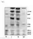 Fig. 03 - Method of separating glycolipids