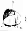 Fig. 50 - System and methods for screening a luminal organ (