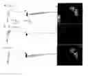 Fig. 01 - Methods and systems for assessing biological material using optical detection techniques