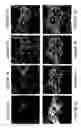 Fig. 09 - Methods and systems for assessing biological material using optical detection techniques