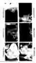 Fig. 10 - Methods and systems for assessing biological material using optical detection techniques