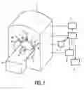 Fig. 02 - Diagnostic apparatus with an automatic visualization of scan planes