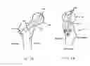 Fig. 02 - Enhanced graphics features for computer assisted surgery system