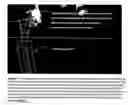 Fig. 08 - Pre-operative planning of implantations