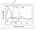 Fig. 01 - Method and system for quantification of arterial stenosis