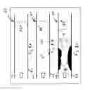 Fig. 04 - Method and system for quantification of arterial stenosis