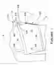 Fig. 02 - Shoulder brace
