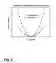 Fig. 06 - Continuous volume detection for a flexible venous reservoir in a cardiopulmonary bypass circuit