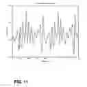 Fig. 12 - Continuous volume detection for a flexible venous reservoir in a cardiopulmonary bypass circuit
