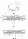 Fig. 05 - Apparatus and method for delivery of therapeutic and/or diagnostic agents