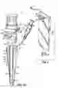 Fig. 02 - Fluid delivery trocar-cannula complex, fluid delivery accessory, and method for delivering fluids during minimally invasive surgery
