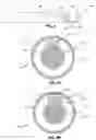 Fig. 06 - Guidewire for crossing occlusions or stenoses