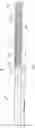 Fig. 08 - Guidewire for crossing occlusions or stenoses