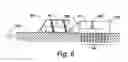 Fig. 06 - Hydraulically actuated pump for long duration medicament administration