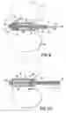 Fig. 07 - Selectively passive forward shielding medical needle device
