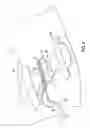 Fig. 04 - Selectively passive shieldable medical needle device