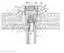 Fig. 01 - Transcutaneous portal device