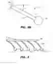 Fig. 05 - Surgical instrument for adhering to tissues
