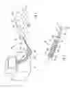 Fig. 02 - Articulating catheter tip with wedge-cuts