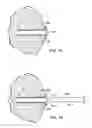 Fig. 13 - Devices and methods for performing procedures on a breast
